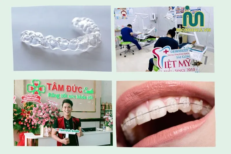 Top 5 Địa Chỉ Niềng Răng Cà Mau Uy Tín