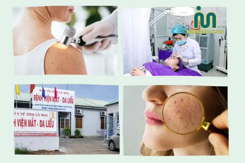 Top địa chỉ bệnh viện da liễu Cà Mau